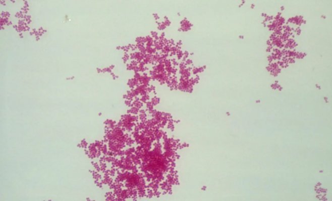 За неделю коклюшем заболели еще 1100 человек