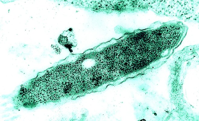 Люди экономят на нагреве воды. В этом году от легионеллеза уже умерли 17 человек