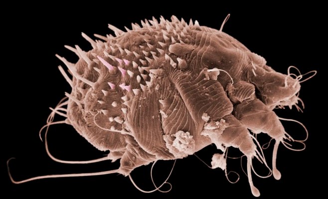 Число случаев чесотки растет