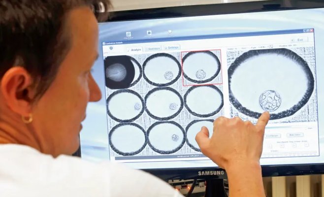 Государство ограничит донорство яйцеклеток и сумму выплат женщинам