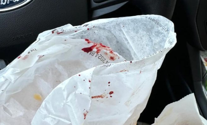 Мама, я не хочу кетчуп! В бургере четырехлетней девочки оказалась кровь с пальца повара