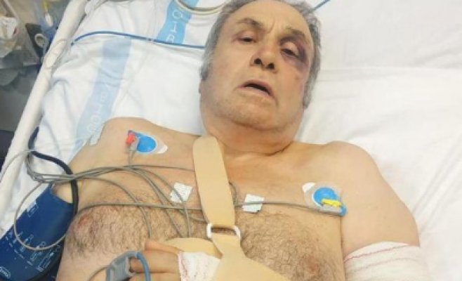 Четверо немцев жестоко избили 71-летнего таксиста на Майорке: Есть подозрения в том, что они полицейские