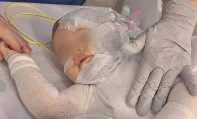 В Австралии мужчина специально вылил на ребенка горячий кофе: малыш получил серьезные ожоги