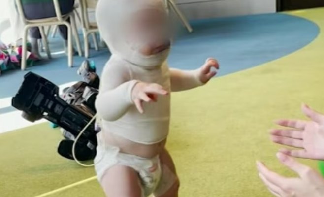 В Австралии мужчина специально вылил на ребенка горячий кофе: малыш получил серьезные ожоги