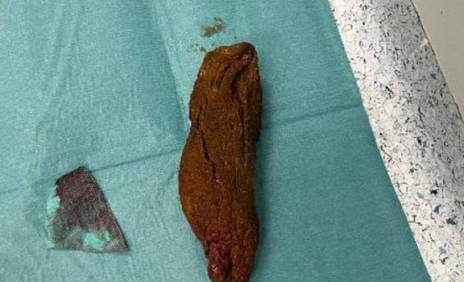 Мужчина требует 3 миллиона за ошибку врачей. Больница считает, что одного миллиона достаточно