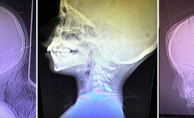 Снимки с пулями в головах палестинских детей вызывают сомнения