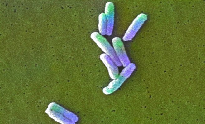 Люди экономят на нагреве воды, случаи заражения легионеллой бьют рекорды