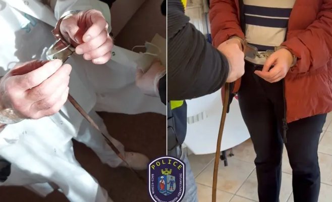 Венгерская полиция задержала двух врачей за нелегальные операции по смене пола