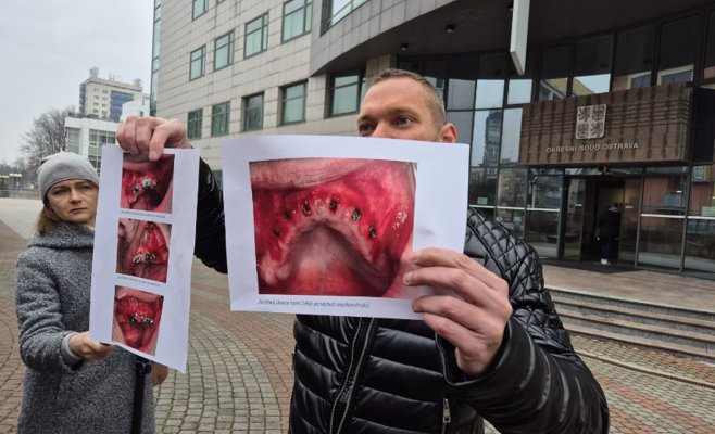 Пациент требует миллионы за испорченные челюсти. Стоматолог платить отказывается