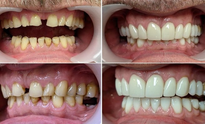 Smile Centrum отмечает 13 лет успеха открытием девятой клиники в Праге