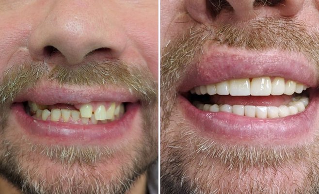 Smile Centrum отмечает 13 лет успеха открытием девятой клиники в Праге