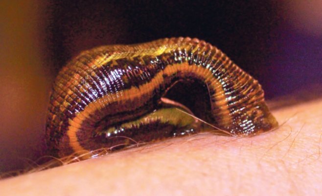 В Польше нашли мертвого мужчину в ванне, полной пиявок. Следствие считает, что это было самоубийство