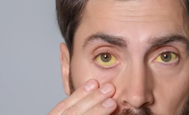 В Праге от гепатита А с начала года умерли 13 человек. За неделю заразилось больше людей, чем за весь прошлый год