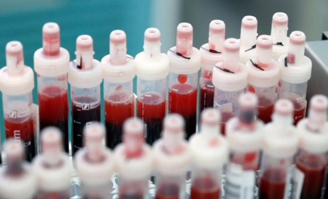 Растёт интерес к тестированию антител к гепатиту А