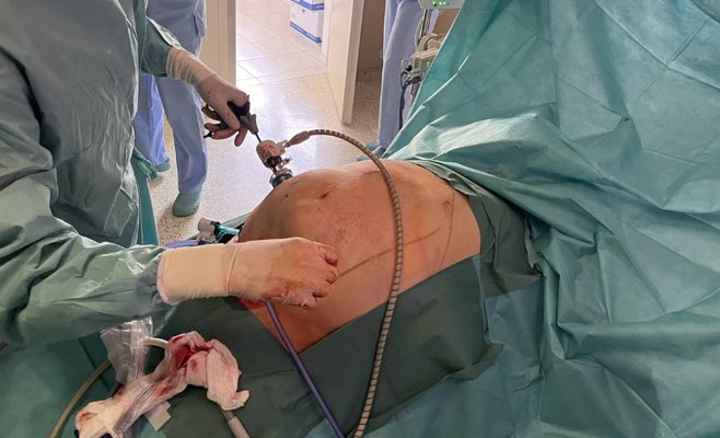 Не мог избавиться от грыжи — помог уникальный щадящий метод. Но сначала пришлось похудеть