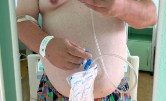 Не мог избавиться от грыжи — помог уникальный щадящий метод. Но сначала пришлось похудеть