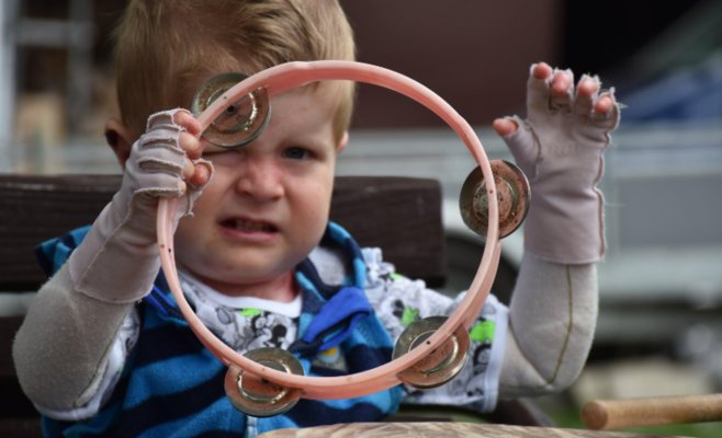 Детские опухоли, болезнь «бабочкиных крыльев»: обновлённый павильон поможет разрабатывать лечение для пациентов