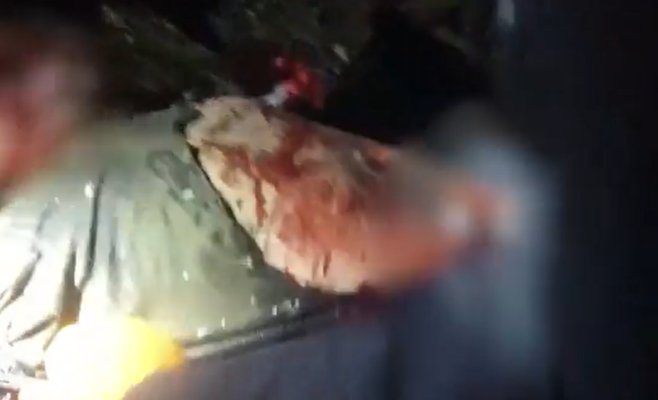 Мужчинам, потерявшим руки при запуске новогодних петард, грозит уголовное преследование