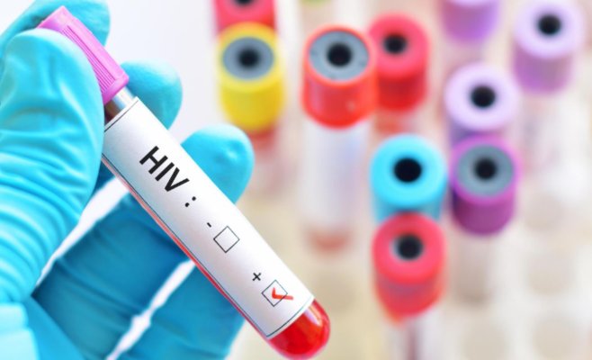 В Чехии не удаётся остановить распространение ВИЧ: число новых случаев бьёт рекорды