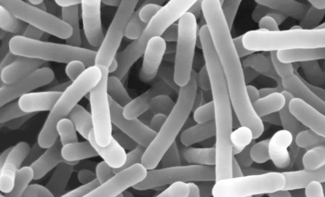 В колбасе с черемшой обнаружили опасную бактерию: покупателей просят вернуть продукт