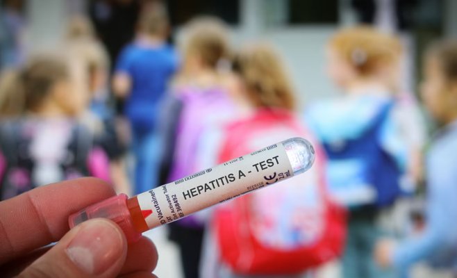 Гепатитом А за два года заболели более пяти тысяч человек. Каждый сотый умер