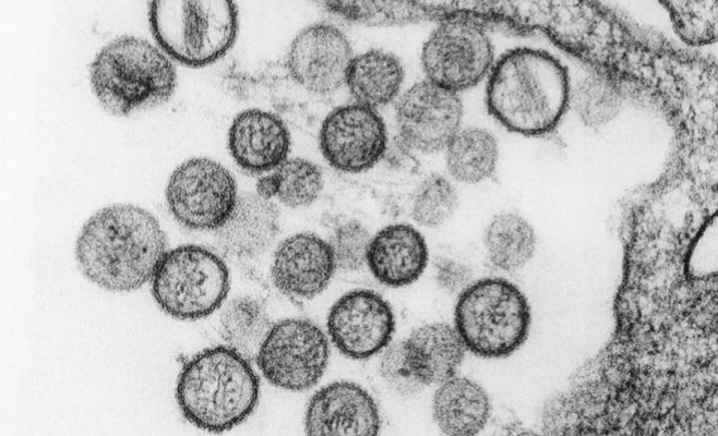 Аргентинский вирус смертелен, но новой пандемии не ждут: ни вакцины, ни лечения