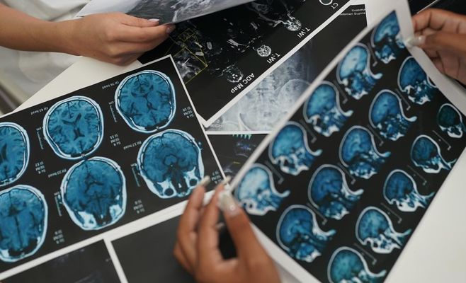 Свинцеві фартухи на рентгені не захищають, а лише підвищують ризик, визнають чеські лікарі