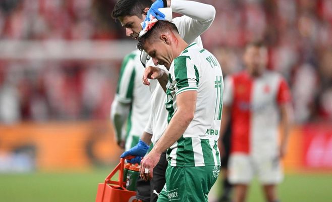 Pilař leaves Slavia clash with ten stitches in his head — opponent gets only a yellow card
