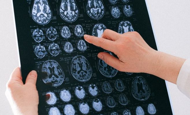Your Brain May Flicker Between What You See and Don't Notice 15 Times a Second