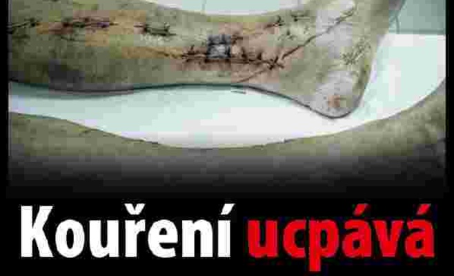 В Чехии будут продавать пачки сигарет с пугающими картинками