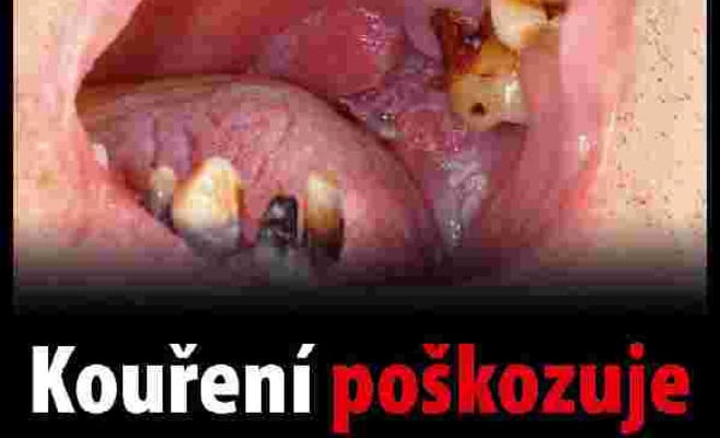 В Чехии будут продавать пачки сигарет с пугающими картинками