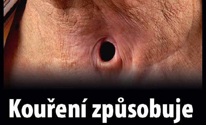 В Чехии будут продавать пачки сигарет с пугающими картинками