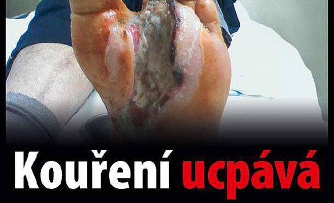 В Чехии будут продавать пачки сигарет с пугающими картинками